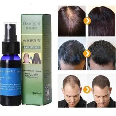 Hair Growth Serum - Homestore Bargains